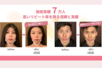 見てわかる変化が、リピーターを生み続ける。施術実績7万人。